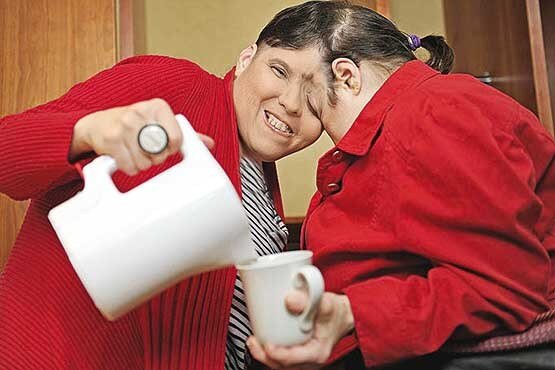 عجیب‌ترین دوقلوهای جهان را بشناسید/ عکس