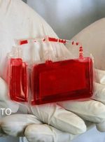 پیوند خون بند ناف از بانک سازمان انتقال خون به کودک ۵ ساله