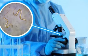 آزمایش مدفوع؛ هرآنچه باید بدانید