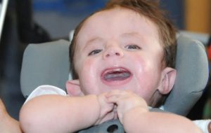 تریزومی ۱۸؛ همه‌چیز درباره این بیماری ژنتیکی جنین