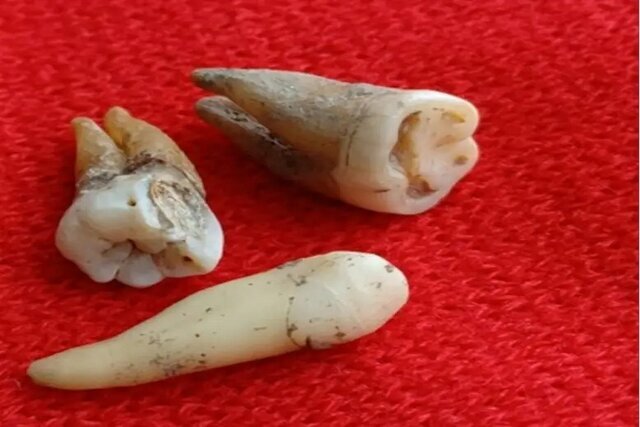 استخراج پادتن زنده از دندان‌های ۸۰۰ ساله/ عکس