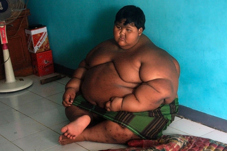 آریا پرمانا؛ چاق ترین کودک جهان