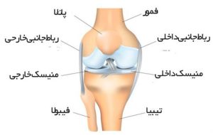 روش درمان گرفتگی رگ پشت زانو چپ