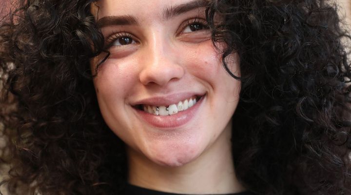 کاشت نگین دندان