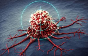 سلول‌های ایمنی بدن از مبارزه با سرطان خسته می‌شوند!