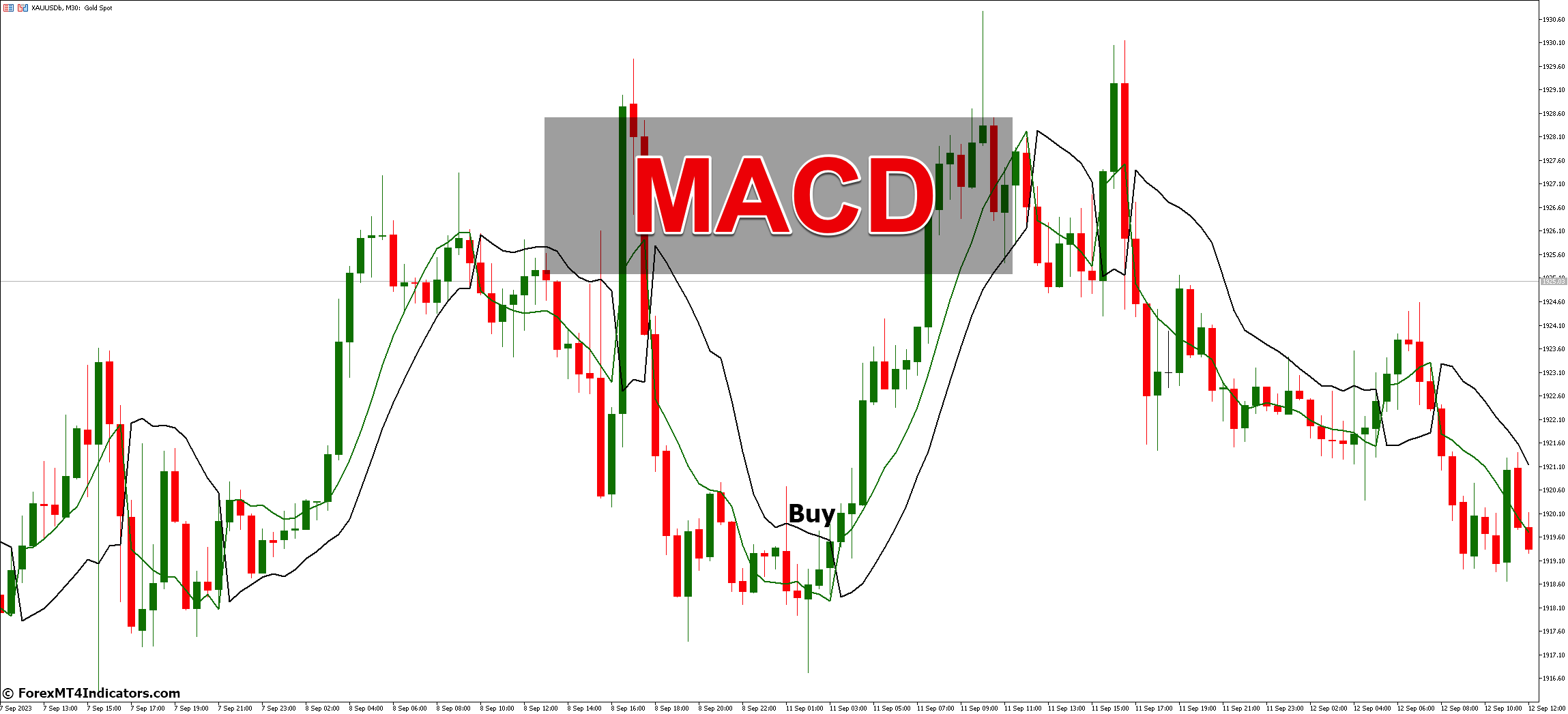 MACD