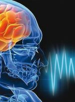 هفت عامل باورنکردنی سکته مغزی را بشناسید