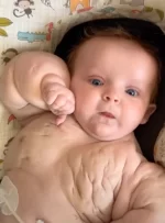 بچه هالک، این نوزاد شبیه یک فرد بدن ساز است!