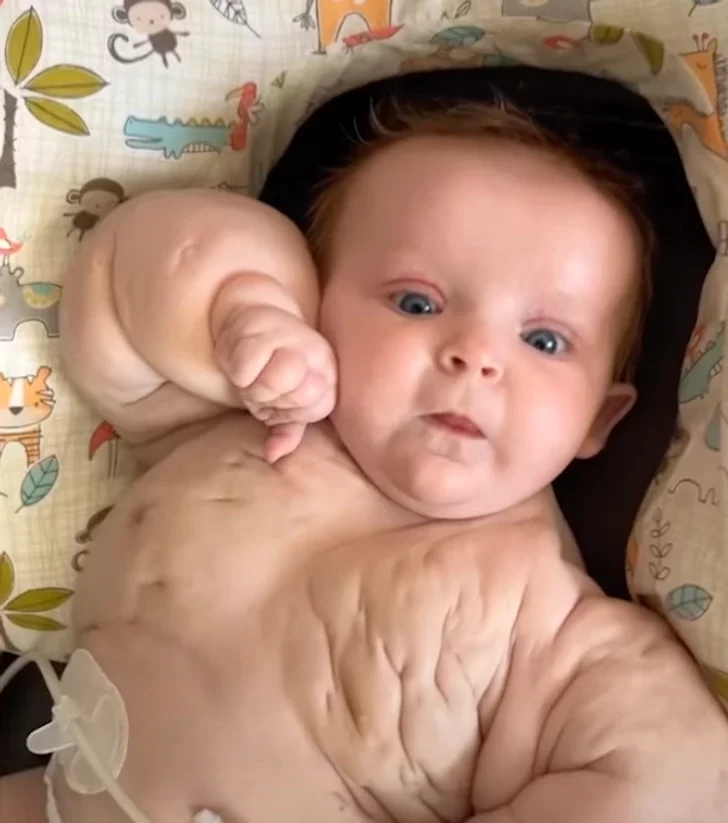 بچه هالک نوزادی که انگار بدنسازی کار کرده است