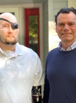 اولین عمل پیوند چشم کامل در آمریکا