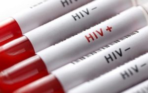 آخرین وضعیت HIV در کشور