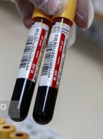 آغاز آزمایش ملکولی بسیار پیشرفته خون‌های اهدایی در تهران برای اولین‌بار