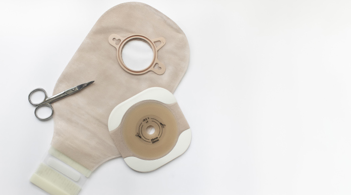 ایلئوستومی - روند جراحی ایلئوستومی