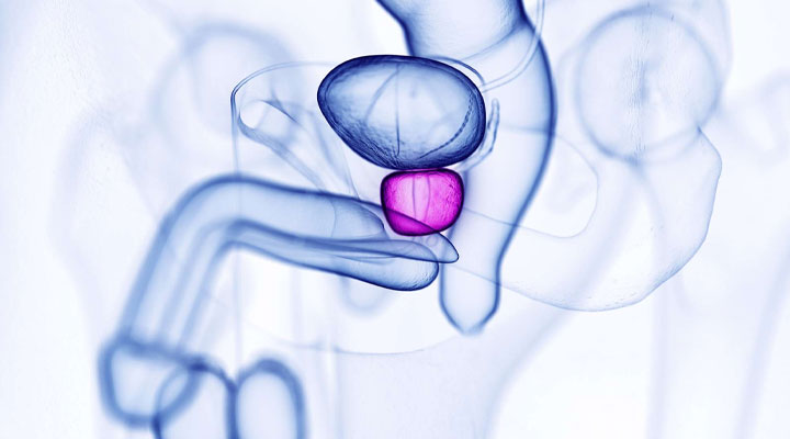 ماساژ پروستات برای تحریک جنسی