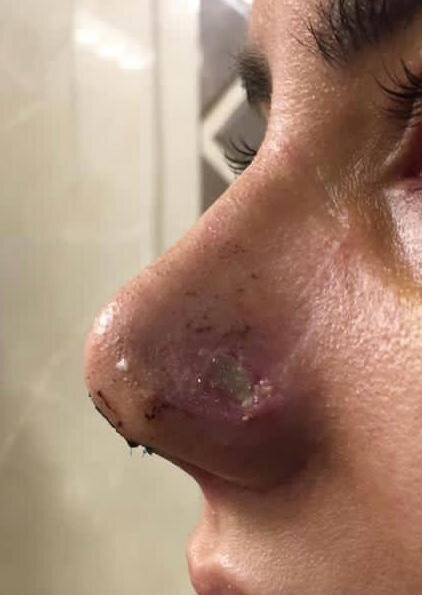 کاهش سن جراحی‌های زیبایی به ۱۴ سال / افزایش تقاضا در مردان و کهنسالان