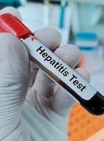 برنامه وزارت بهداشت برای حذف «هپاتیت C»/ برآورد ابتلای ۲۰۰ هزار ایرانی