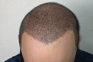 یه روزه مو بکار؛ قسطی پرداخت کن (فقط تا پایان امروز)