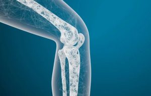 علت عمده پوکی استخوان چیست؟