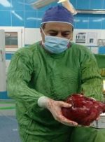 تومور ۳.۵ کیلویی از کلیه یک بیمار ۵۱ ساله در تربت حیدریه خارج شد