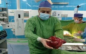 تومور ۳.۵ کیلویی از کلیه یک بیمار ۵۱ ساله در تربت حیدریه خارج شد