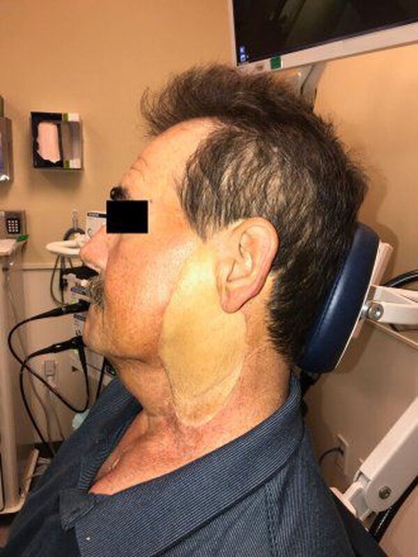 اگر مسواک نزنید به این نوع سرطان مبتلا می‌شوید