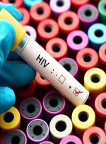 مشاوره، جزو لاینفک تست HIV / نتایج پویش اخیر وزارت بهداشت