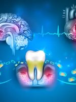 ویدیو/ آیا باکتری‌های دهان بر زوال عقل تاثیر دارند؟