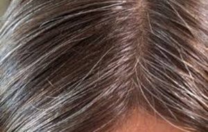 کمبود این ویتامین‌ها سبب سفیدی موی سر می‌شود