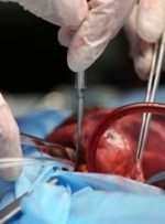 درج نشان «اهدای عضو» در گواهینامه‌های رانندگی