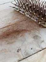 دلایل ریزش موی جلوی سر در زنان