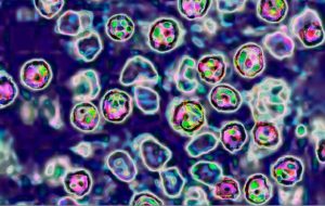 نرخ ابتلا به سرخک در ۲۵ سال اخیر در اروپا رکورد زد