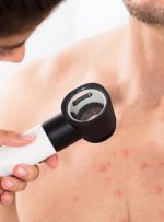 علت جوش روی سینه و ۸ روش درمان خانگی آن