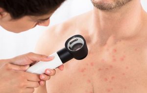 علت جوش روی سینه و ۸ روش درمان خانگی آن