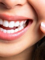 با این ویتامین‌ها دندان‌هایی مثل برف داشته باشید