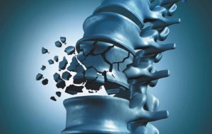 میوه‌ای که استخوان‌های‌تان را از پوک شدن نجات می‌دهد