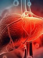 کاهش خطر ابتلا به کبد چرب با مصرف این مواد غذایی